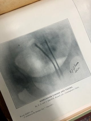 ARCHIVES OF THE ROENTGEN RAY Over 100 issues (including duplicates), unbound and bound, of "The Roentgen Ray" 1897-1914, some of which were from the library of Dr. A. Howard Pirie
