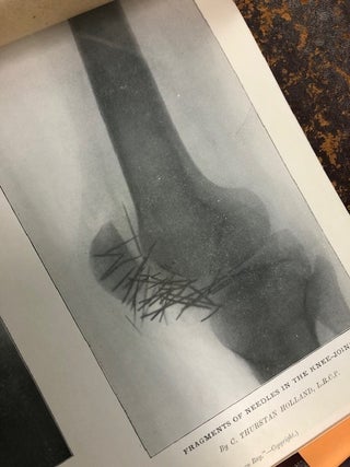 ARCHIVES OF THE ROENTGEN RAY Over 100 issues (including duplicates), unbound and bound, of "The Roentgen Ray" 1897-1914, some of which were from the library of Dr. A. Howard Pirie